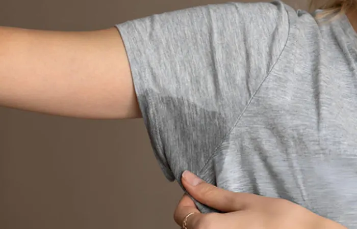 Hyperhidrosis treatment in Cape Town